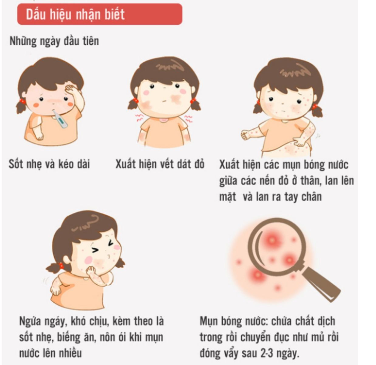 2.1. BENH THUY DAU